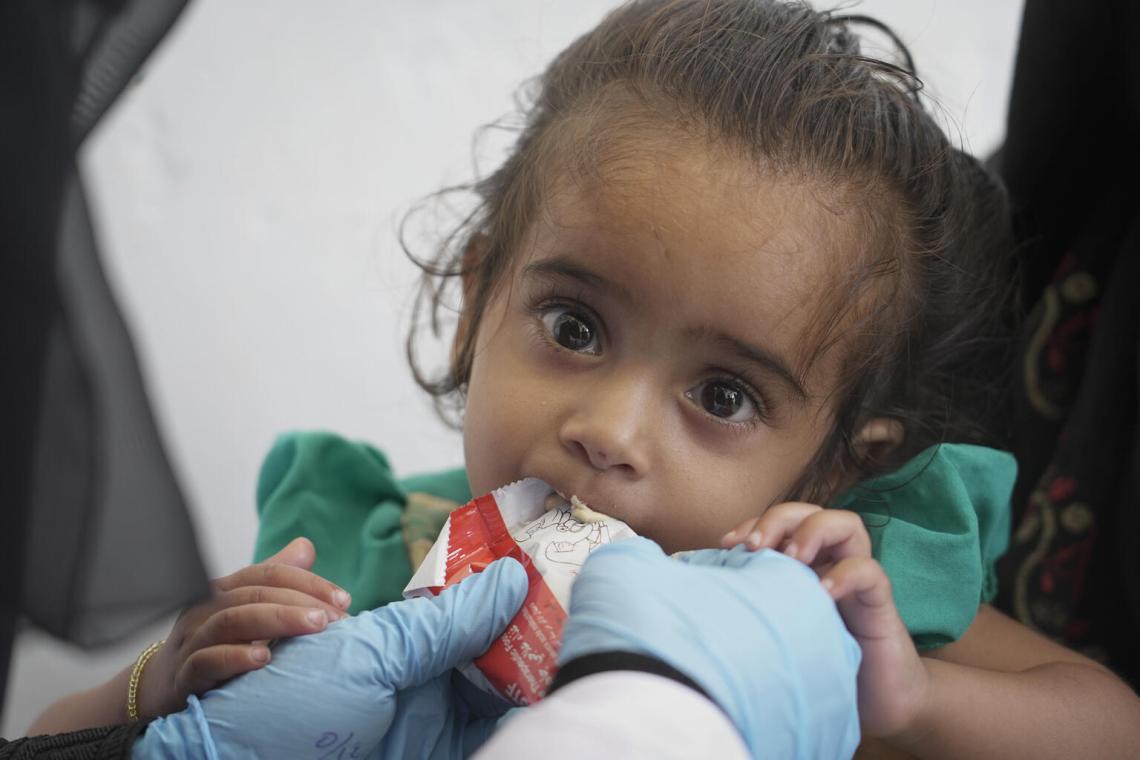 تسعى اليونيسف جاهدة لتزويد الأطفال في اليمن بالدعم التغذوي الذي يحتاجونه من أجل نموهم وتنميتهم